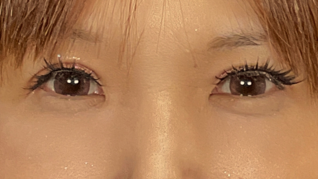 Postoperative Condition Part 1