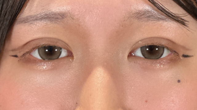 Postoperative Condition Part 1