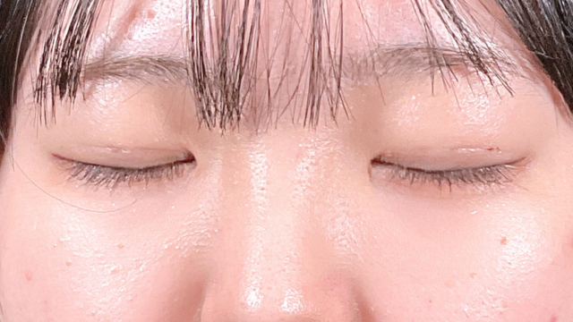 Postoperative Condition Part 1