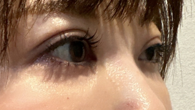 Postoperative Condition Part 1