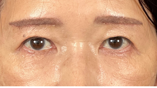 Postoperative Condition Part 1