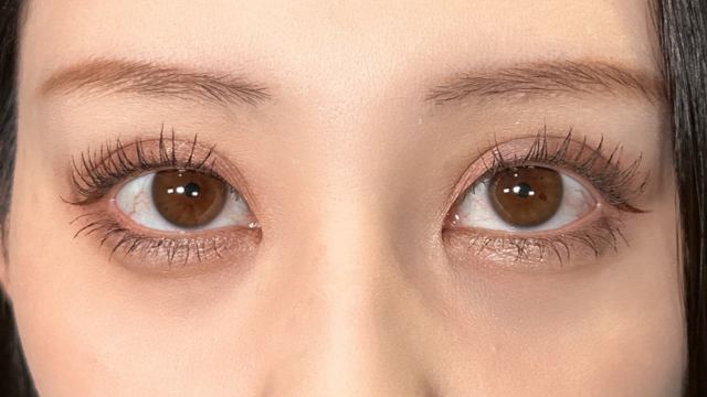 Postoperative Condition Part 1