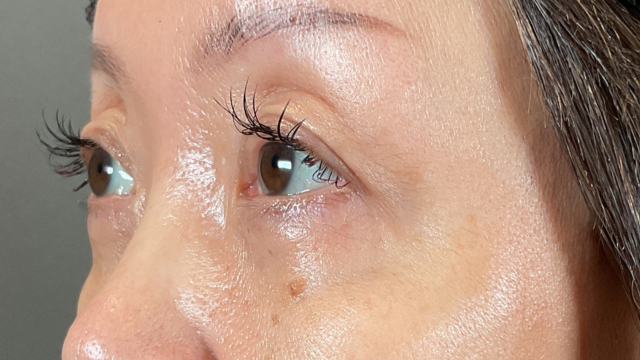 Postoperative Condition Part 1