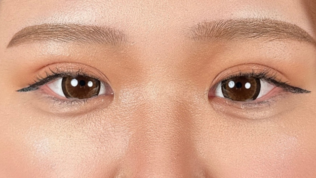 Postoperative Condition Part 1