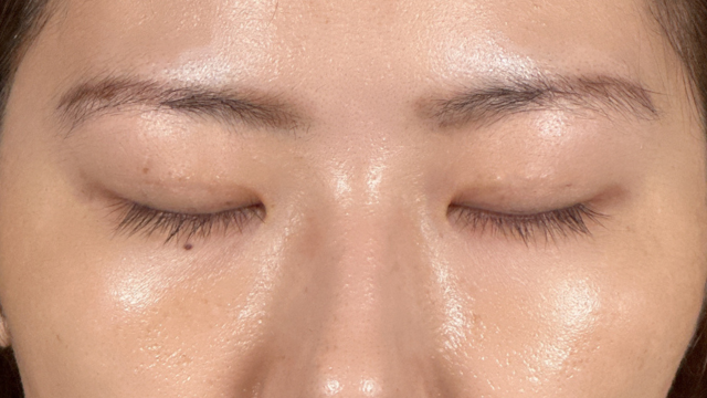 Postoperative Condition Part 1