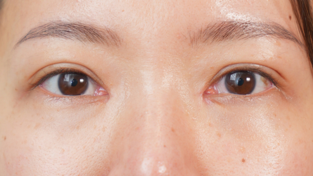 Postoperative Condition Part 1