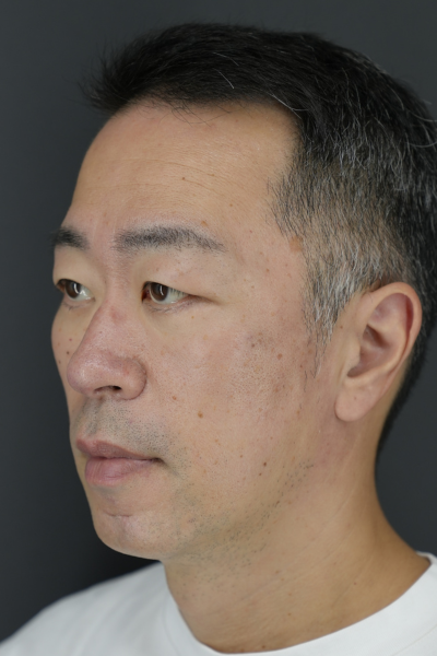 Postoperative Condition Part 1