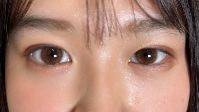 Postoperative Condition Part 1