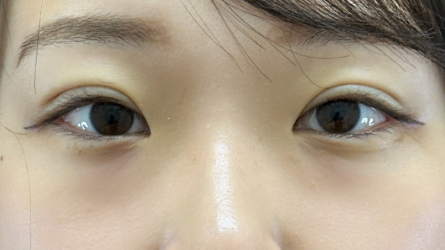 Postoperative Condition Part 1