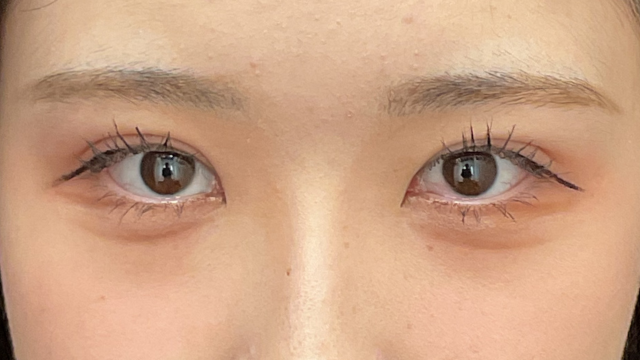 Postoperative Condition Part 1