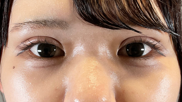 Postoperative Condition Part 1