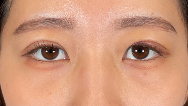 Postoperative Condition Part 1