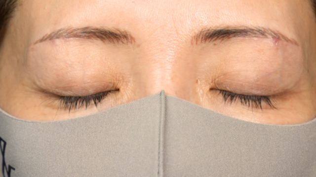 Postoperative Condition Part 1