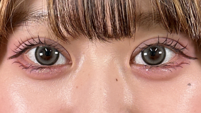 手術前の状態 その1