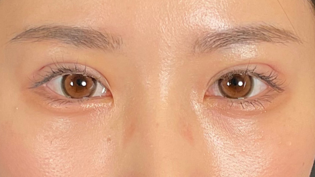 Postoperative Condition Part 1