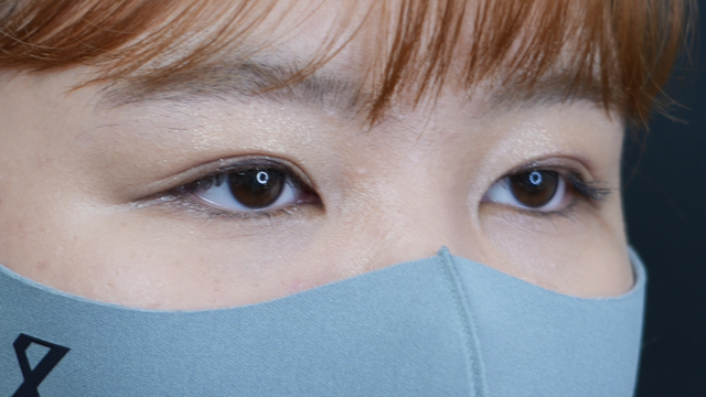 Postoperative Condition Part 1