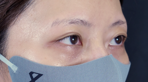 Postoperative Condition Part 1