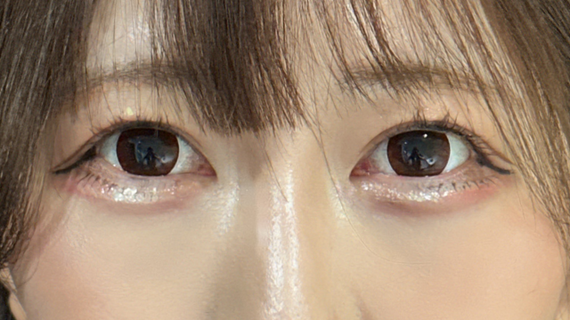 Postoperative Condition Part 1