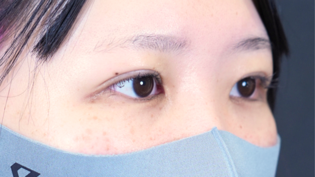 Postoperative Condition Part 1