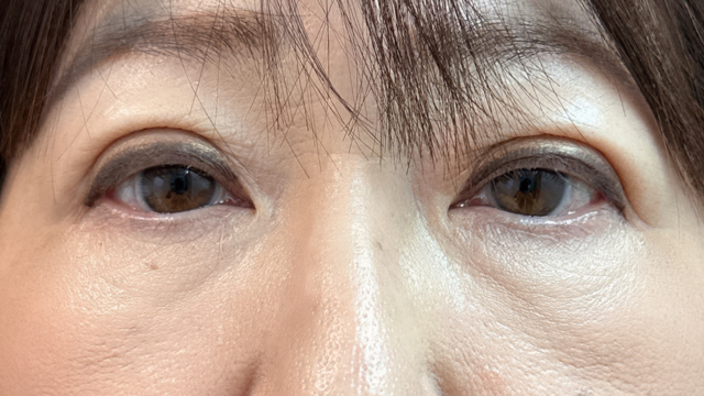 Postoperative Condition Part 1