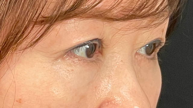 Postoperative Condition Part 1