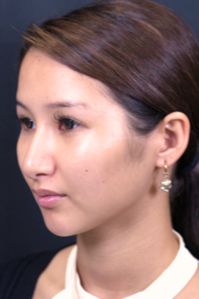 Postoperative Condition Part 1