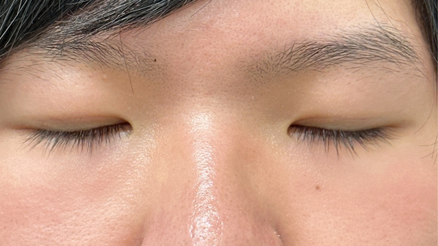 Postoperative Condition Part 1