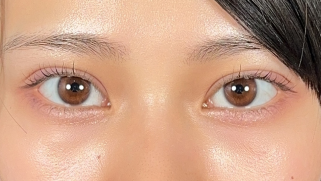 Postoperative Condition Part 1