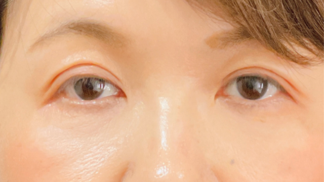 Postoperative Condition Part 1