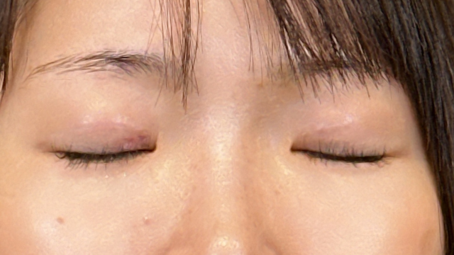 Postoperative Condition Part 1