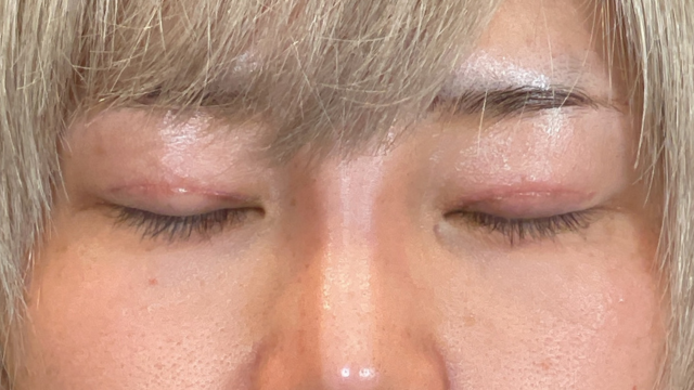 Postoperative Condition Part 1