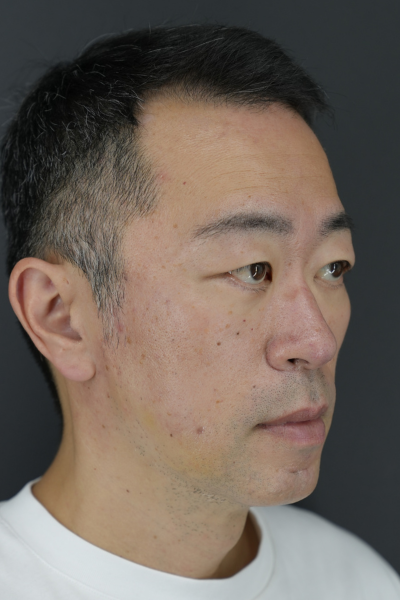 Postoperative Condition Part 1