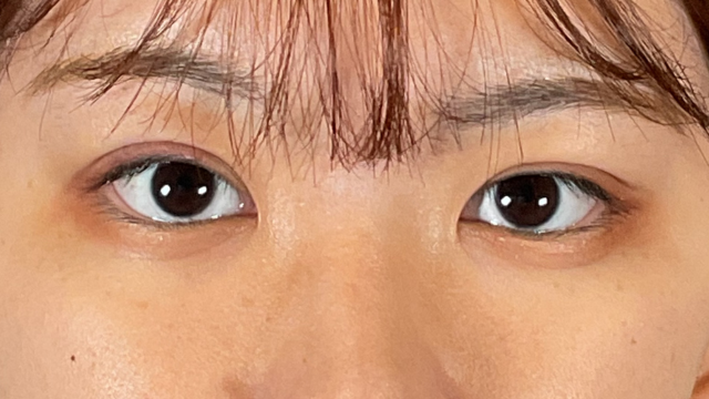 Postoperative Condition Part 1