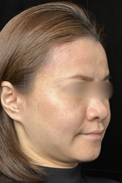 手術前の状態 その1