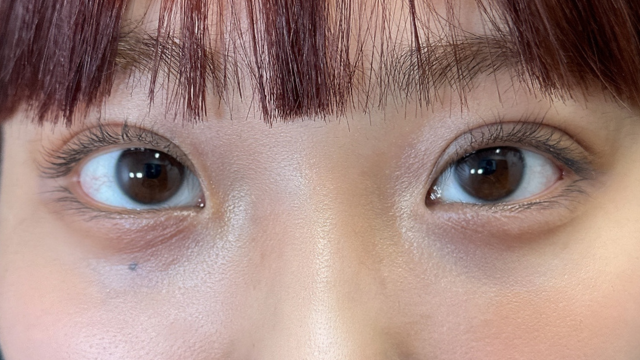 Postoperative Condition Part 1