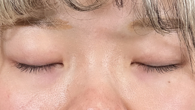 Postoperative Condition Part 1