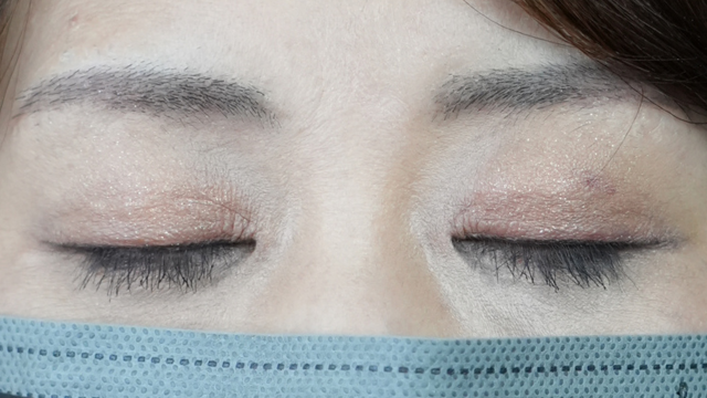 Postoperative Condition Part 1