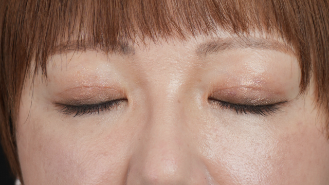 Postoperative Condition Part 1