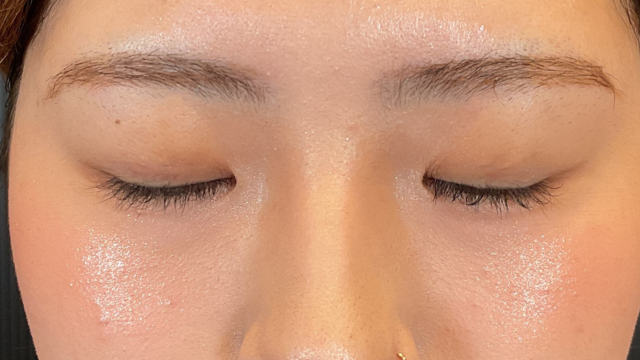 Postoperative Condition Part 1