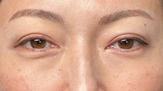 Postoperative Condition Part 1