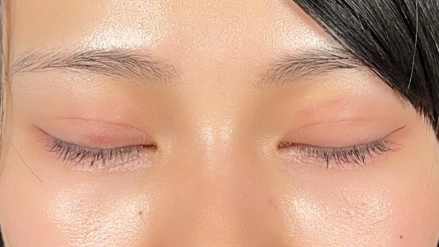 Postoperative Condition Part 1