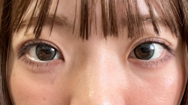 Postoperative Condition Part 1