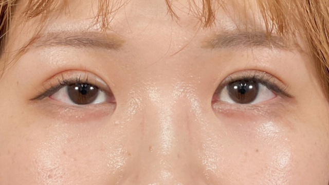 Postoperative Condition Part 1