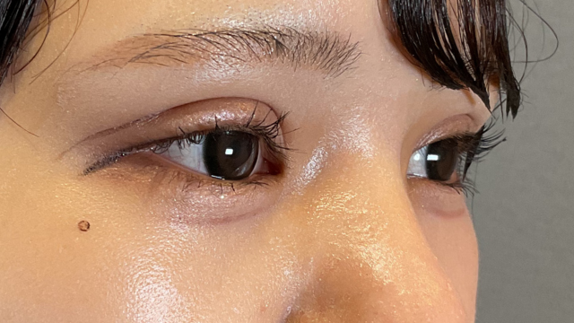 Postoperative Condition Part 1