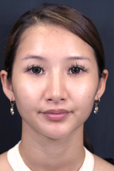 Postoperative Condition Part 1