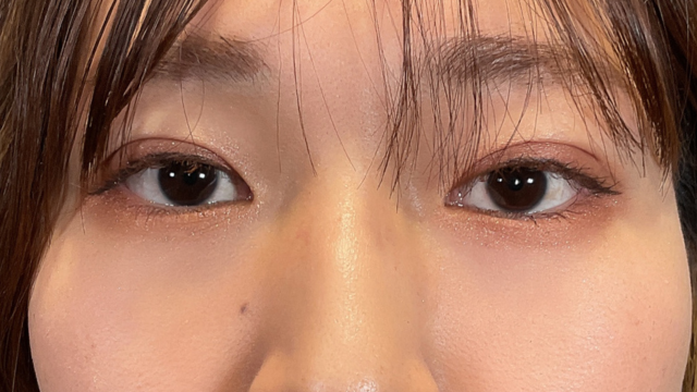 Postoperative Condition Part 1