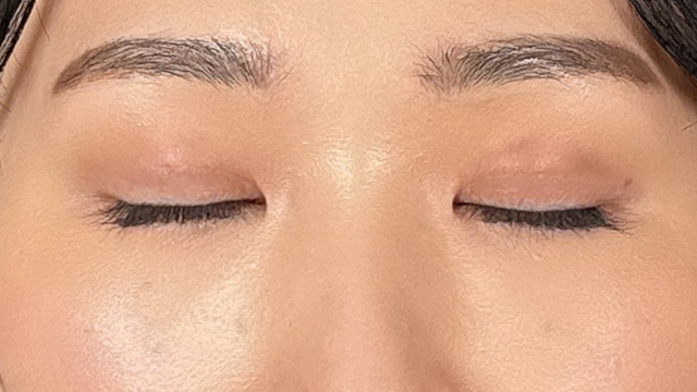 Postoperative Condition Part 1