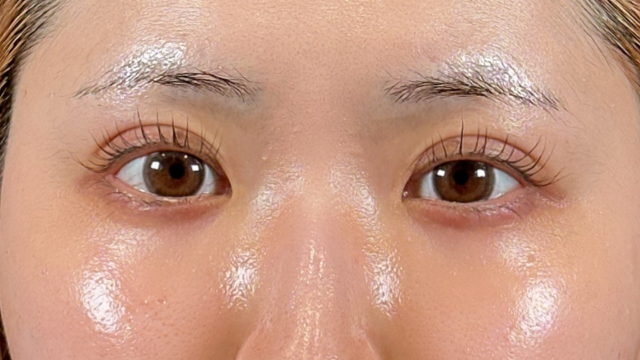 Postoperative Condition Part 1