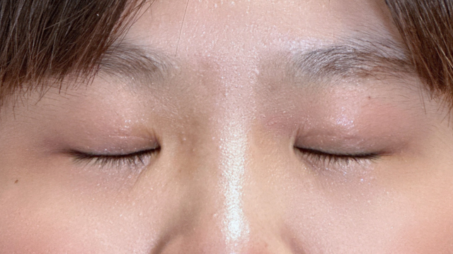 Postoperative Condition Part 1