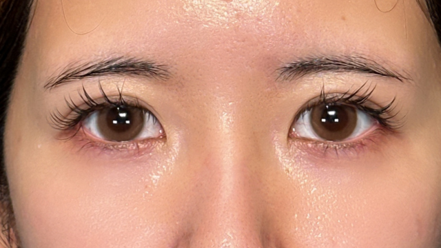 Postoperative Condition Part 1